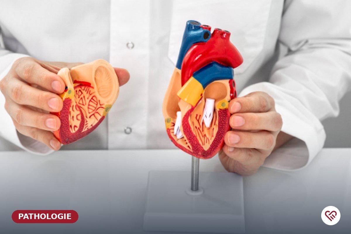 L'angine de poitrine (angor) — Dr Agueznai, cardiologue à Casablanca