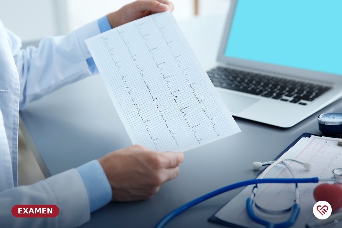 L'électrocardiogramme (ECG) — cabinet du Dr Agueznai