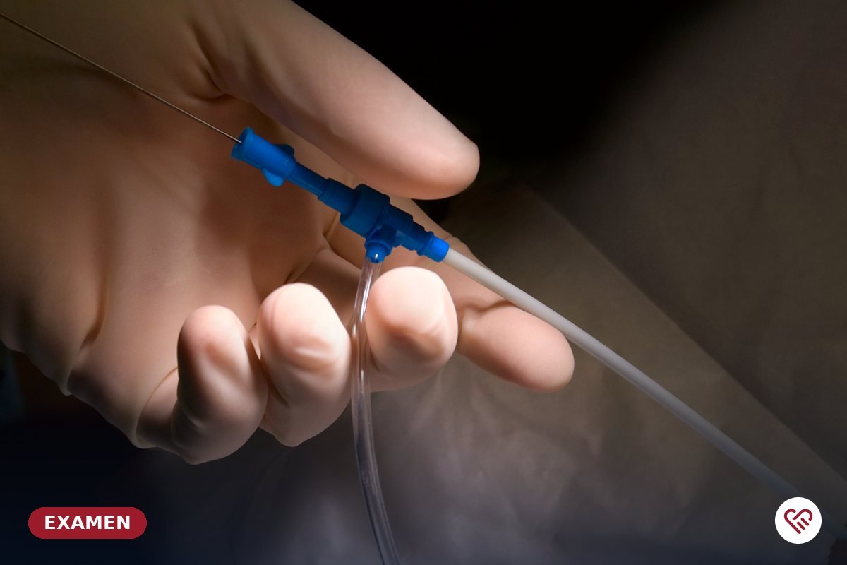 La coronarographie et l'angioplastie coronaire — cabinet du Dr Agueznai
